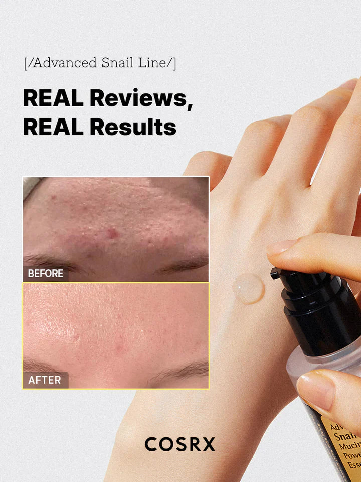 Cosrx Advanced Snail 96 Mucin Power Essence - Koreancare