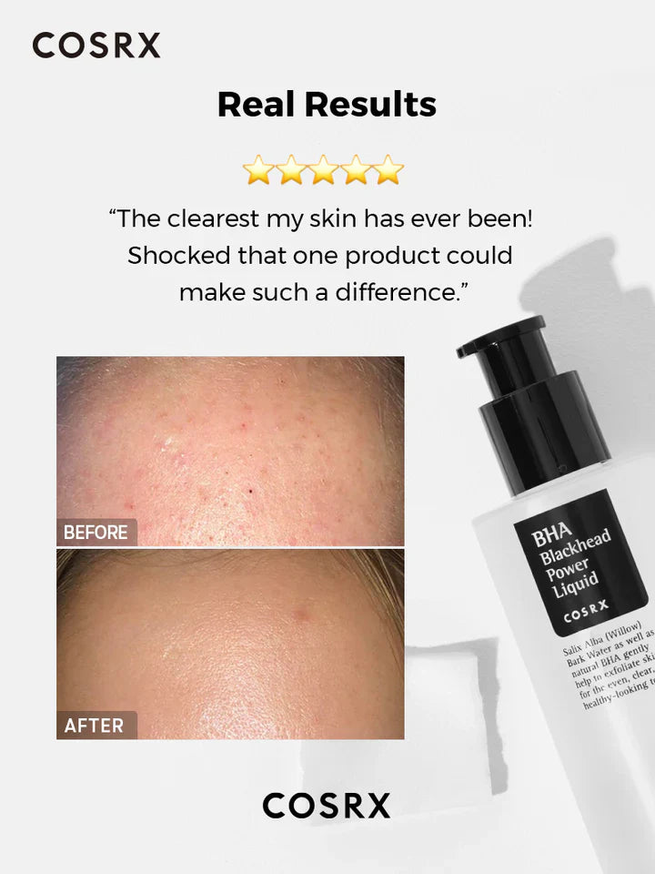 COSRX BHA Blackhead Power Liquid Exfoliating Essence - Koreancare