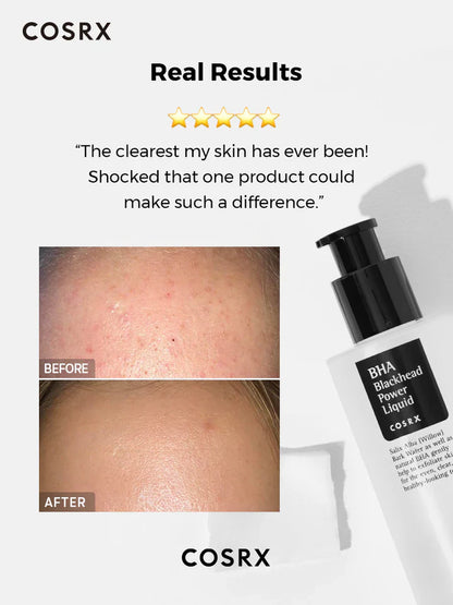 COSRX BHA Blackhead Power Liquid Exfoliating Essence - Koreancare