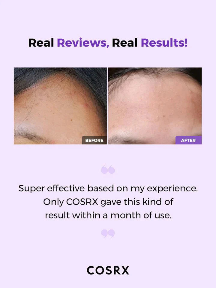 Exfoliating toner COSRX - AHA/BHA Clarifying Treatment Toner - Koreancare