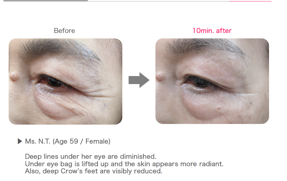 Eye patches with a rose Rosy drop Stretch Sheets eye patches - single pack 2 pcs - Koreancare