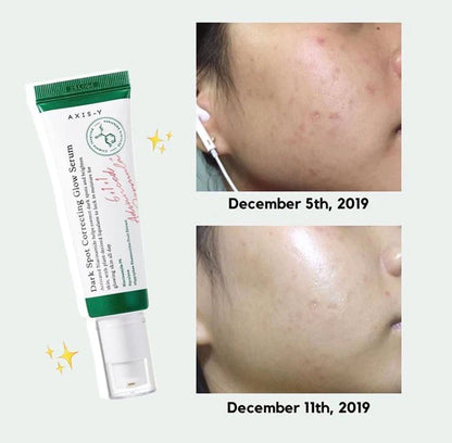 Axis-Y Dark Spot Correcting Glow Serum 50ml - Koreancare